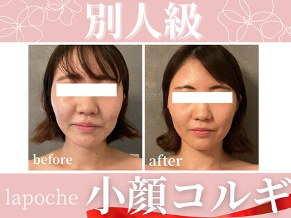 ラポッシュ(La poche)の写真
