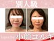 ラポッシュ(La poche)の写真