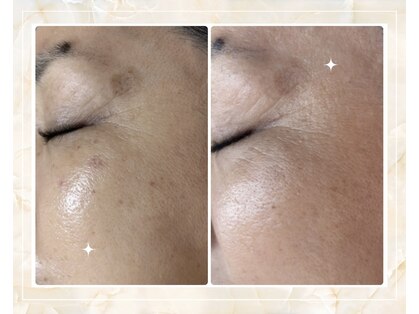 サロンルナ(Salon Luna)の写真