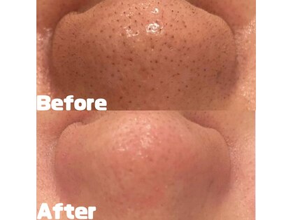 ミセル(MISEL)の写真