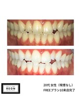 レオン 磐田(REON)/◇ お客様 before＆after ◇