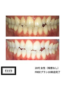 レオン 磐田(REON)/◇ お客様 before＆after ◇