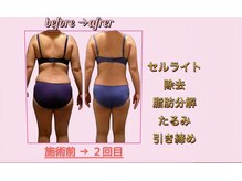 広尾痩身ビューティーサロン/【痩身/広尾/ダイエット】