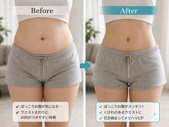 アプロ(Aphro)/ぽっこりお腹卒業