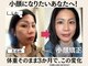 キッカ 岡山店(kikka)の写真/むくみやたるみを改善!頭皮から整えて本来のフェイスラインへ★小顔矯正×マシン×ヘッドスパが人気◎