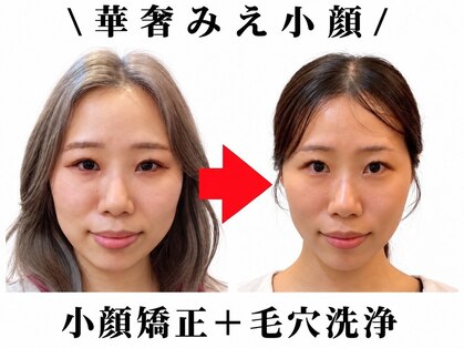 ブプラ 金山店(BUPURA)の写真