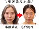 ブプラ 金山店(BUPURA)の写真