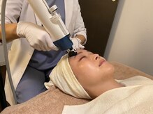 タイディ(TIDY)/エクソソーム　ヒト幹細胞