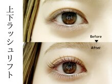 アイビューティー エピ(EyeBeauty epi)/上下ラッシュリフト