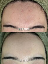 サロンドジェシカ(salon de Jessica)/プラズマ