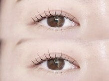 フィールリファイン(Feel Refine)