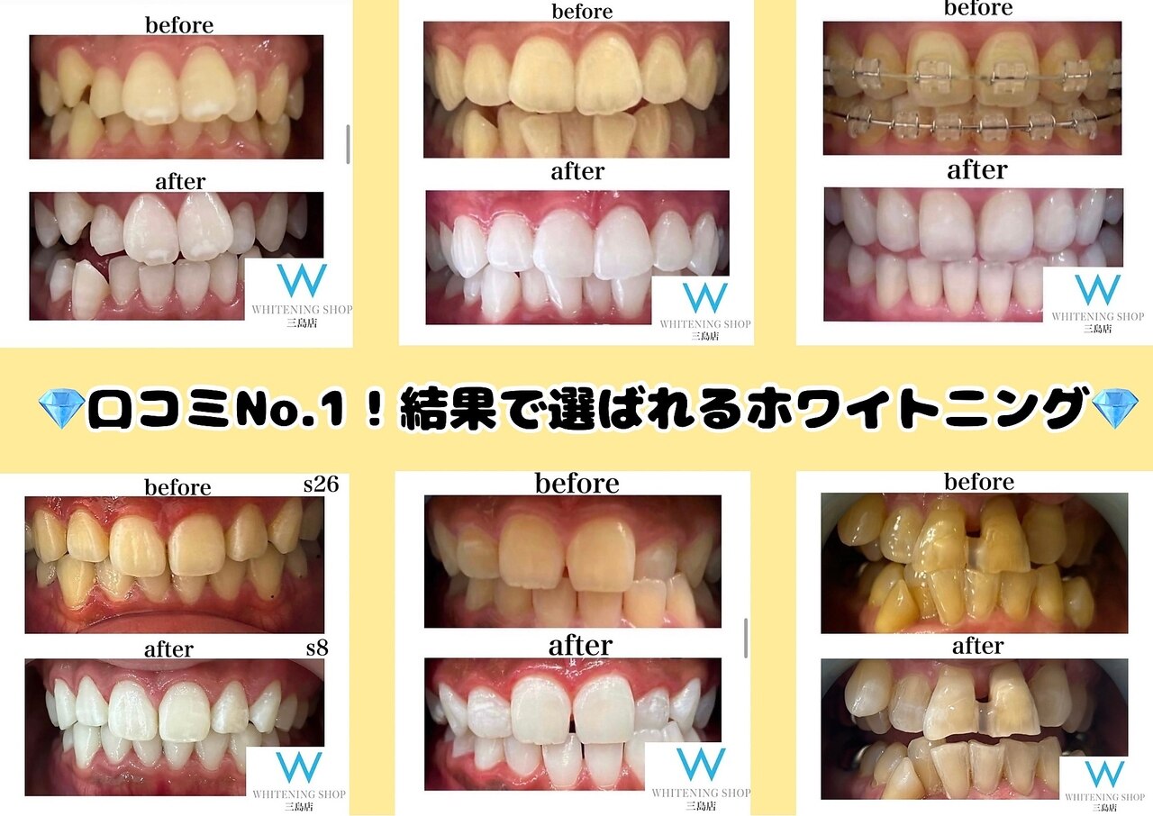 ホワイトニングショップ 三島店(WHITENING SHOP)｜ホットペッパー