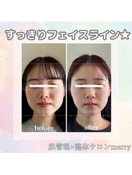 メリー 大和八木店(merry)/むくみ、もたつきの解消へ★