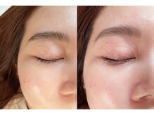 リッド(ride)/【HBL】ハリウッドブロウリフト