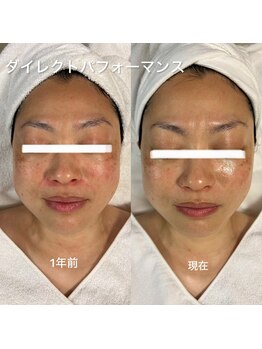 デディア 恵比寿(dedia)/レチノールで肌質強化