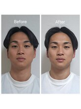 ネマウム(nemaum)/脳美容ドライヘッドスパ