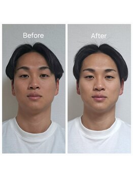 ネマウム(nemaum)/脳美容ドライヘッドスパ