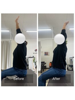 ナオル整体 大里院(NAORU整体)/50代女性 慢性的な首肩コリ