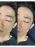 メンズ眉毛WAXスタイリング＋額WAX(おでこ)＋目の周りWAX(Cゾーン)¥7800