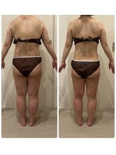 エステサロン ラ マーノ(La mano)/痩身エステ13回目★