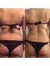 【スペシャル痩身コース】温活を取り入れたダイエットコースです。