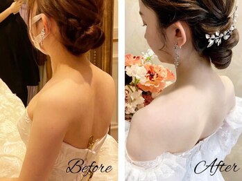 アモリール(Amolir)/ブライダルエステbefore＆after