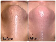 クロス(Xcross)の雰囲気（セラピール/ララピール導入◆韓国式肌管理で毛穴レス/ニキビケア）