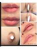 外陰部(Iライン)orビキニラインの黒ずみケア 『ローマピンク』
