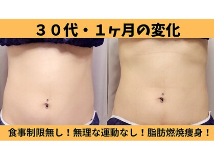 ヨサパーク ヴィオラ(YOSAPARK viola)の写真