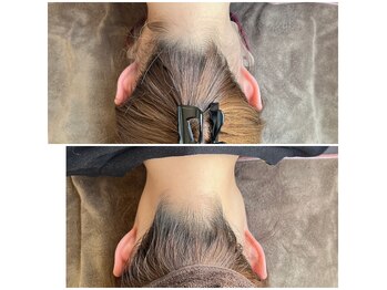 ミース 京都駅前店/うなじビフォーアフター