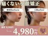★6月限定★【小顔/むくみ】小顔矯正プログラム 60分 ¥8500→¥4980