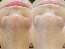 テオリア(TEORIA)/平日はもっとお得にエステ♪