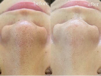 テオリア(TEORIA)/平日はもっとお得にエステ♪