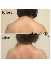サロン ド アール(salon de R.)/【お背中骨氣・20代・施術効果】