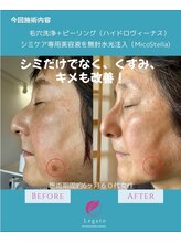 レガート(Legato)/徹底シミケア♪