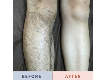 ダンディラボ(Dandy Lab)/ビフォーアフター