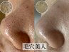 【毛穴美人】毛穴洗浄＋角質ケア＋レチノール導入120分◇¥17600→【¥14300】