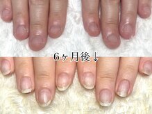 ココモ(cocomo)/(深爪/長さだし/フィルイン)