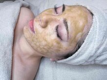 ヴィズクラブ バイ ビネル(Vi's CLUB by BINEL)/ハーブピーリング