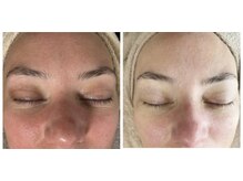 マリエンドリーの雰囲気（肌荒れ、赤ら顔、くすみ、も任せ下さい。）