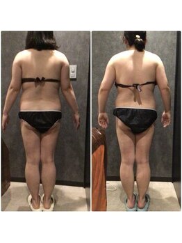 フローボディ 新山口店(flow BODY)/山口のエステはflow BODY