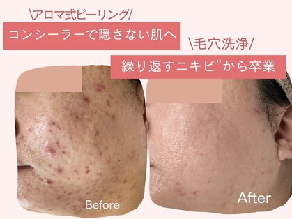 アロマ(AROMA)の写真