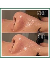 レアリゼ(Realiser)/クリスティーナ☆ビオフィート