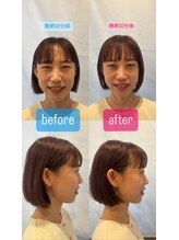 ギンパリ ヒロ トリートメントルーム エム(ginpari HIRO Treatment room M)/美調整フェイシャル