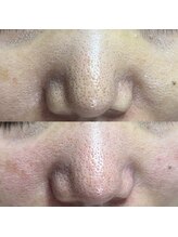 シャイニー(SHINY)/50代女性