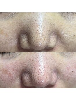 シャイニー(SHINY)/50代女性