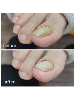 爪切り屋 足楽/