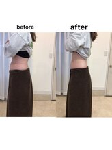 ジョワイユ(Joyeux)/腸の位置でお腹は変わる