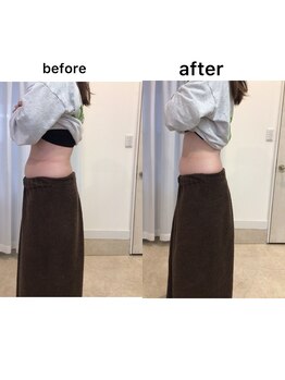 ジョワイユ(Joyeux)/腸の位置でお腹は変わる