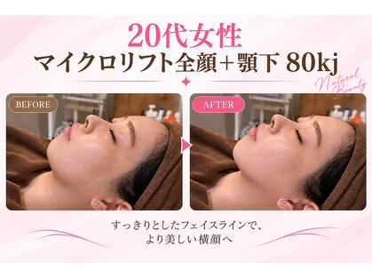 リフト 柏(Lift)の写真